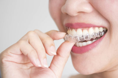 A smiling woman holding invisalign or clear teeth aligners