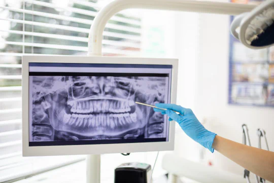 Digital Dental X-Rays available at Ace Dental in Boston, MA